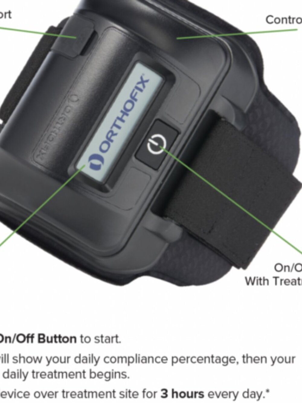 Orthofix Physio Stimulator Bone Growth Leg/Knee/Thigh/Ankle/Arm/Elbow/Wrist